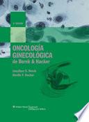 Oncología ginecológica