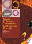 Optical Coherence Tomography in Cardiovascular Research