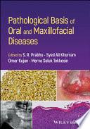 Pathological Basis of Oral and Maxillofacial Diseases