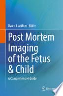Post Mortem Imaging of the Fetus & Child