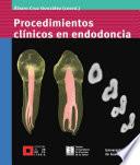 Procedimientos clínicos en endodoncia