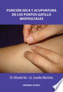 Punción seca y Acupuntura de los puntos gatillo miofasciales