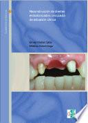Reconstrucción de dientes endodonciados