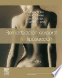 Remodelación corporal y liposucción + ExpertConsult