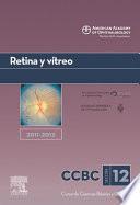 Retina y vítreo. 2011-2012