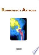 Reumatismo y Artrosis