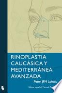 Rinoplastia Caucásica y Mediterránea Avanzada