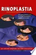 Rinoplastia
