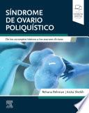 Síndrome de ovario poliquístico