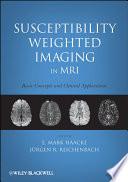 Susceptibility Weighted Imaging in MRI