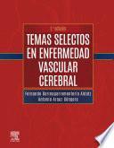 Temas selectos en enfermedad vascular cerebral