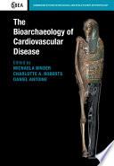 The Bioarchaeology of Cardiovascular Disease