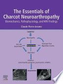 The Essentials of Charcot Neuroarthropathy