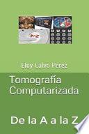 Tomografía Computarizada: de la A A La Z