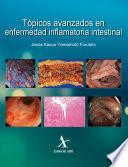 Tópicos avanzados en enfermedad inflamatoria intestinal