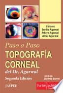 TOPOGRAFÍA CORNEAL