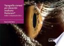 Topografía corneal por elevación mediante Pentacam®
