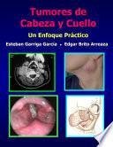 Tumores de Cabeza y Cuello: Un Enfoque Práctico