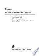 Tumors