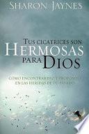 Tus Cicatrices Son Hermosas Para Dios
