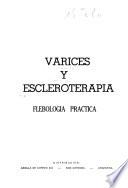 Varices y escleroterapia